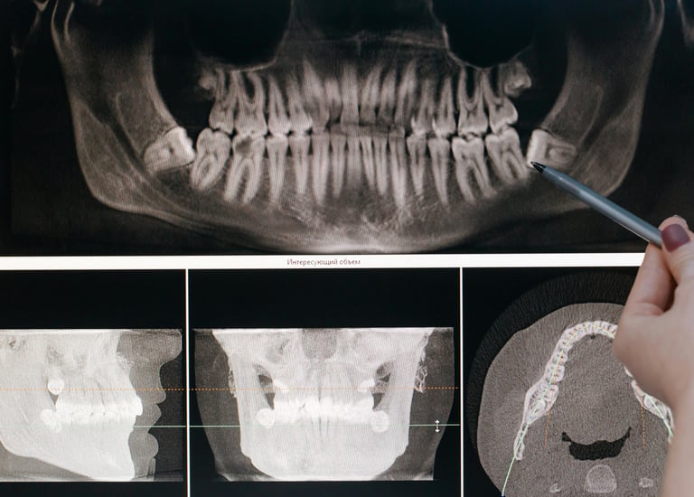 Dentist reviewing a dental x-ray