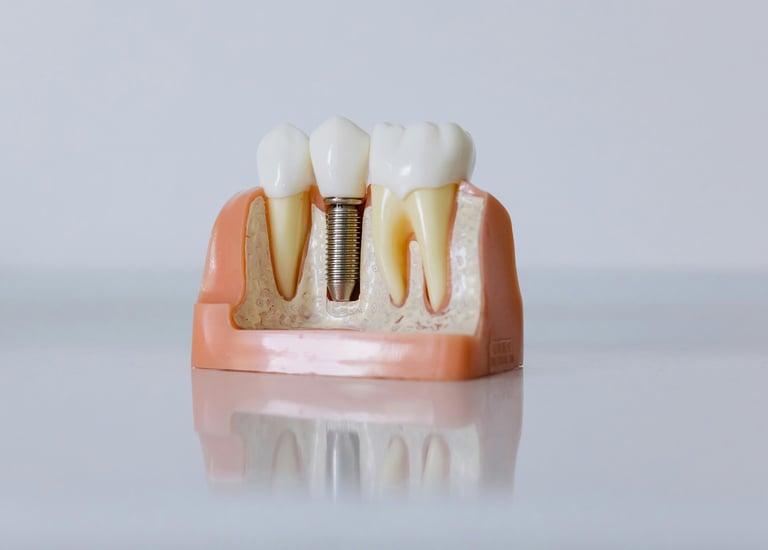Dental implant model with a titanium post and crown